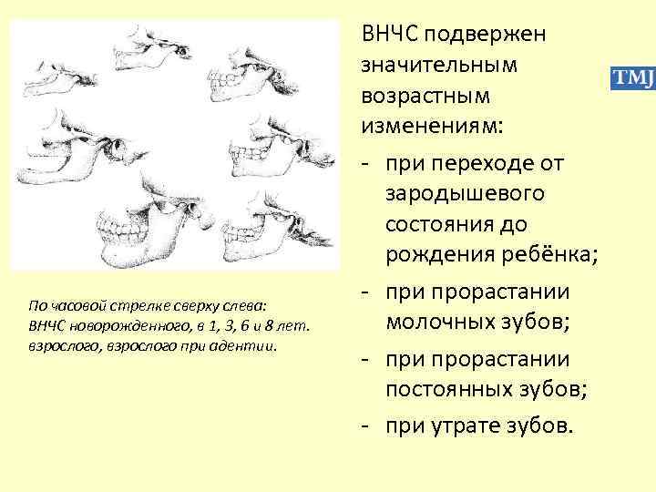 По часовой стрелке сверху слева: ВНЧС новорожденного, в 1, 3, 6 и 8 лет.