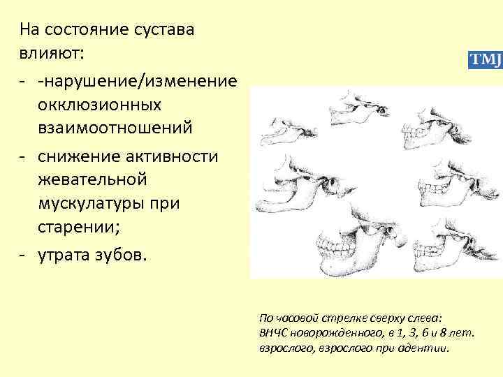 На состояние сустава влияют: - -нарушение/изменение окклюзионных взаимоотношений - снижение активности жевательной мускулатуры при