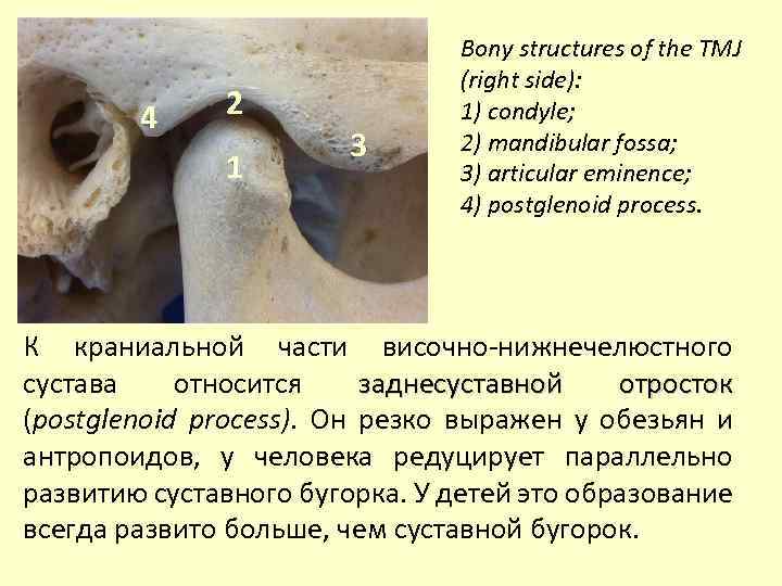 4 2 1 3 Bony structures of the TMJ (right side): 1) сondyle; 2)