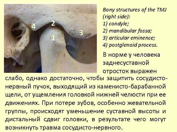 4 2 1 3 Bony structures of the TMJ (right side): 1) сondyle; 2)