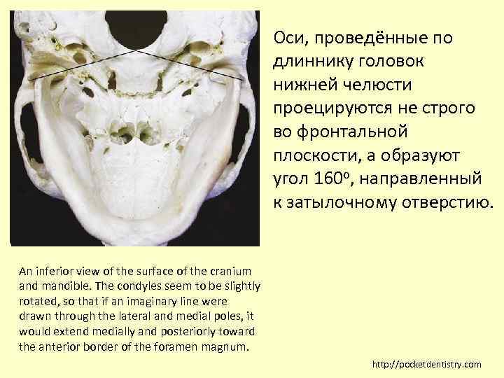 Оси, проведённые по длиннику головок нижней челюсти проецируются не строго во фронтальной плоскости, а