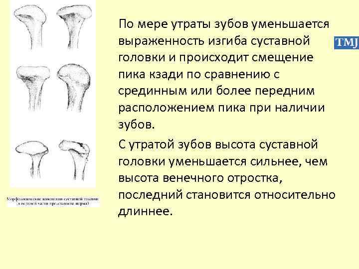 По мере утраты зубов уменьшается выраженность изгиба суставной головки и происходит смещение пика кзади