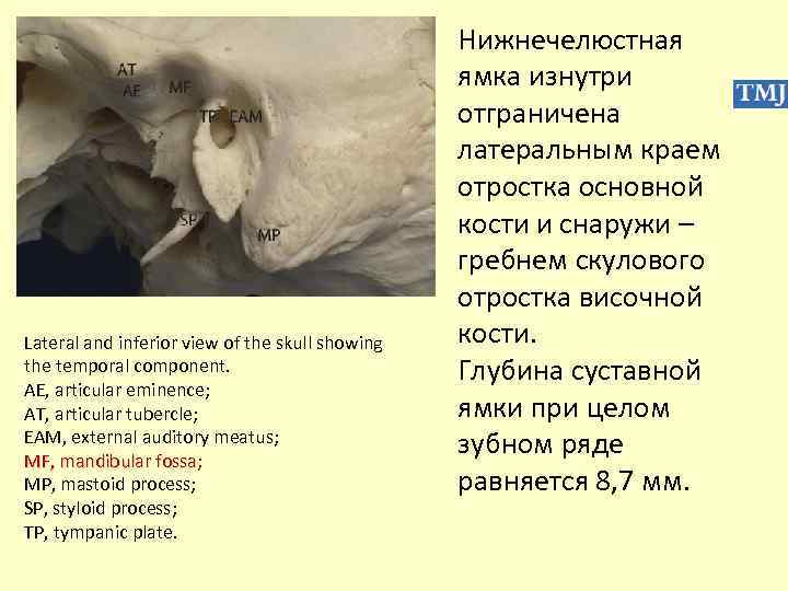 Lateral and inferior view of the skull showing the temporal component. AE, аrticular eminence;