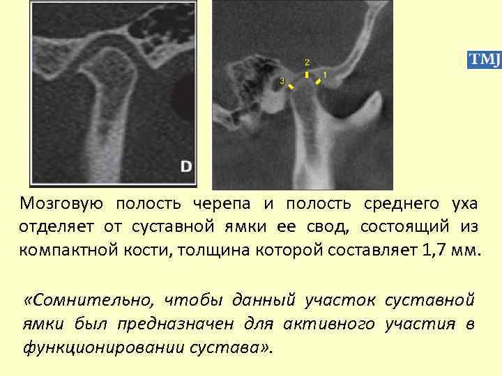 Мозговую полость черепа и полость среднего уха отделяет от суставной ямки ее свод, состоящий