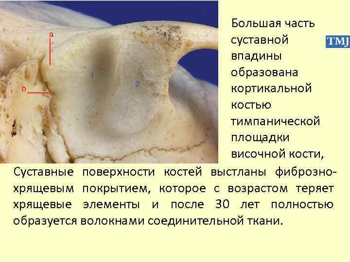 Чем покрыты суставные поверхности костей