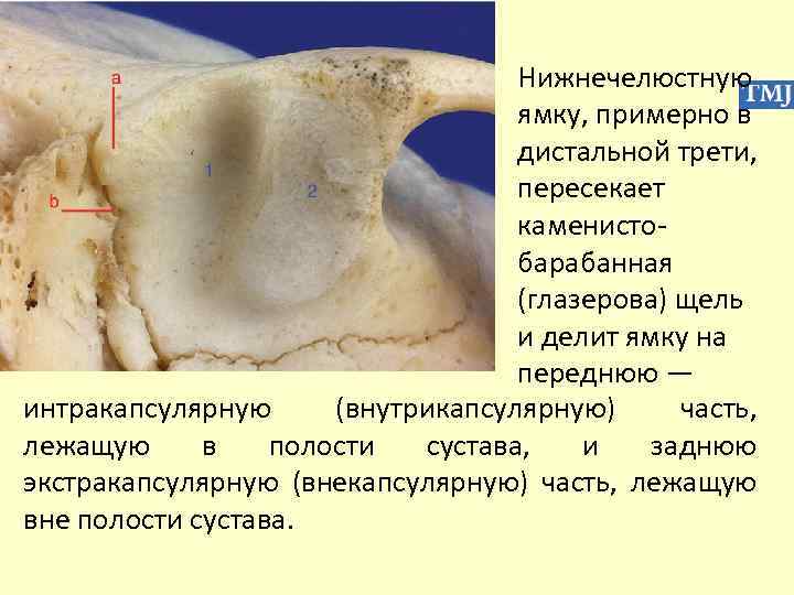 Нижнечелюстную ямку, примерно в дистальной трети, пересекает каменистобарабанная (глазерова) щель и делит ямку на