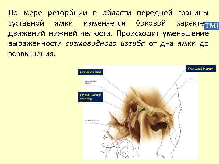 По мере резорбции в области передней границы суставной ямки изменяется боковой характер движений нижней