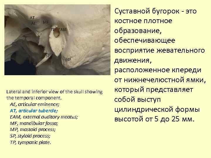 Lateral and inferior view of the skull showing the temporal component. AE, аrticular eminence;