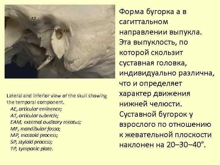 Lateral and inferior view of the skull showing the temporal component. AE, аrticular eminence;