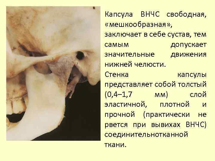 Капсула ВНЧС свободная, «мешкообразная» , заключает в себе сустав, тем самым допускает значительные движения