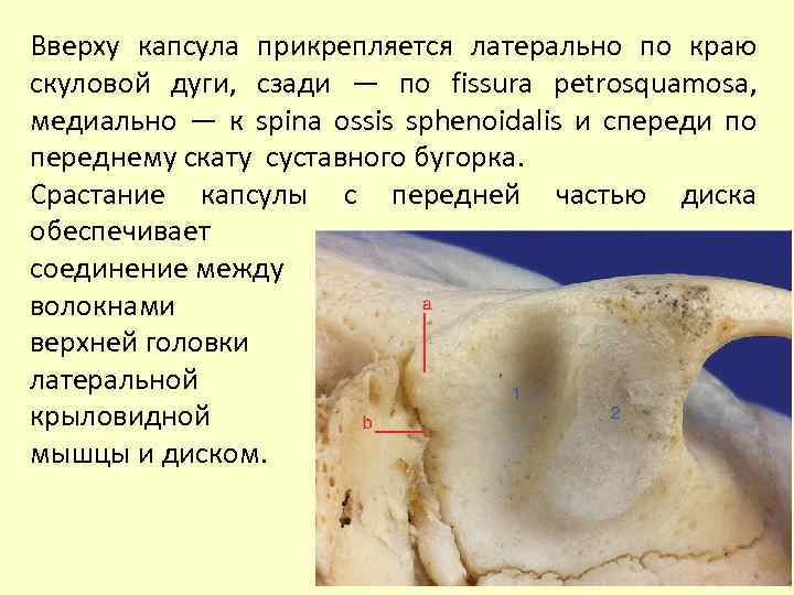Вверху капсула прикрепляется латерально по краю скуловой дуги, сзади — по fissura petrosquamosa, медиально