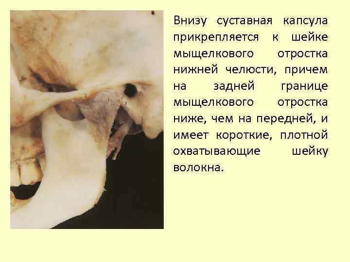 Внизу суставная капсула прикрепляется к шейке мыщелкового отростка нижней челюсти, причем на задней границе