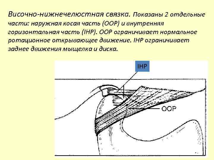 Височно-нижнечелюстная связка. Показаны 2 отдельные части: наружная косая часть (OOP) и внутренняя горизонтальная часть