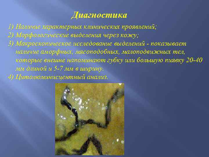 Диагностика 1) Наличие характерных клинических проявлений; 2) Морфологические выделения через кожу; 3) Макроскопическое исследование