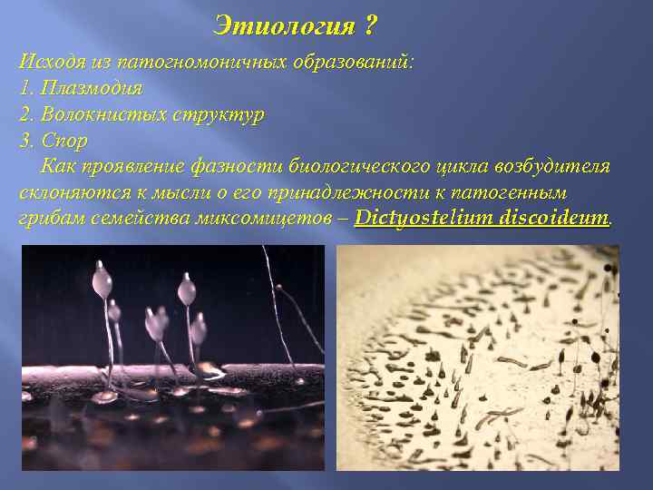 Этиология ? Исходя из патогномоничных образований: 1. Плазмодия 2. Волокнистых структур 3. Спор Как