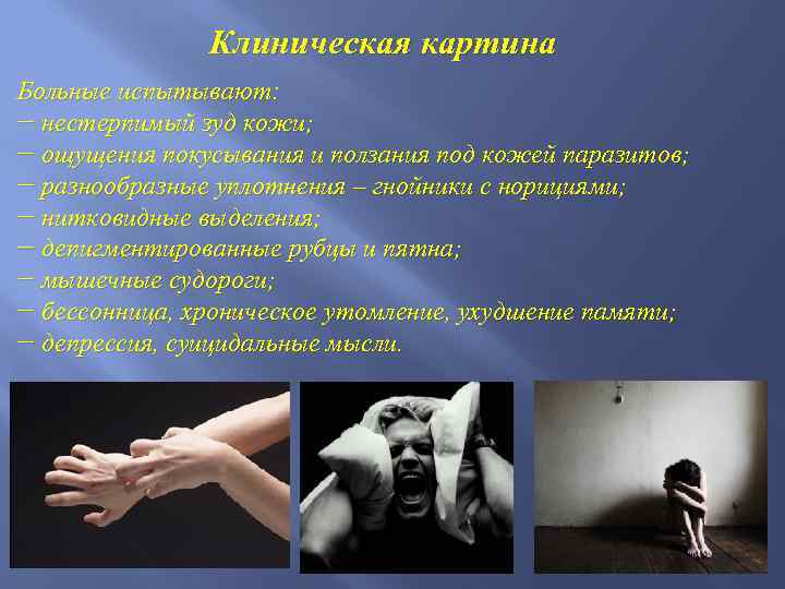 Клиническая картина Больные испытывают: − нестерпимый зуд кожи; − ощущения покусывания и ползания под