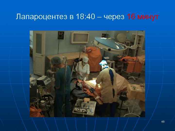 Лапароцентез в 18: 40 – через 16 минут 65 