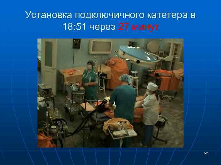 Установка подключичного катетера в 18: 51 через 27 минут 67 