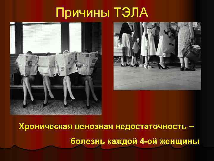 Причины ТЭЛА Хроническая венозная недостаточность – болезнь каждой 4 -ой женщины 