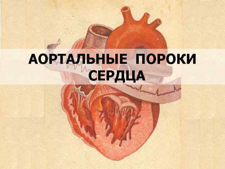 АОРТАЛЬНЫЕ ПОРОКИ СЕРДЦА 