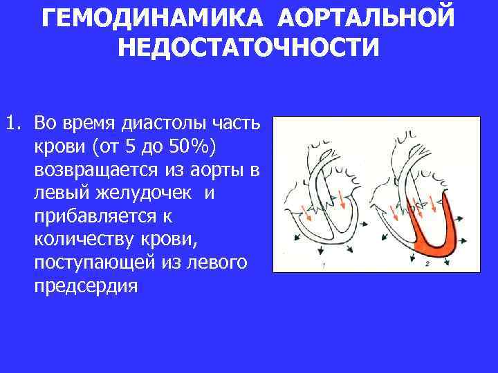 ГЕМОДИНАМИКА АОРТАЛЬНОЙ НЕДОСТАТОЧНОСТИ 1. Во время диастолы часть крови (от 5 до 50%) возвращается