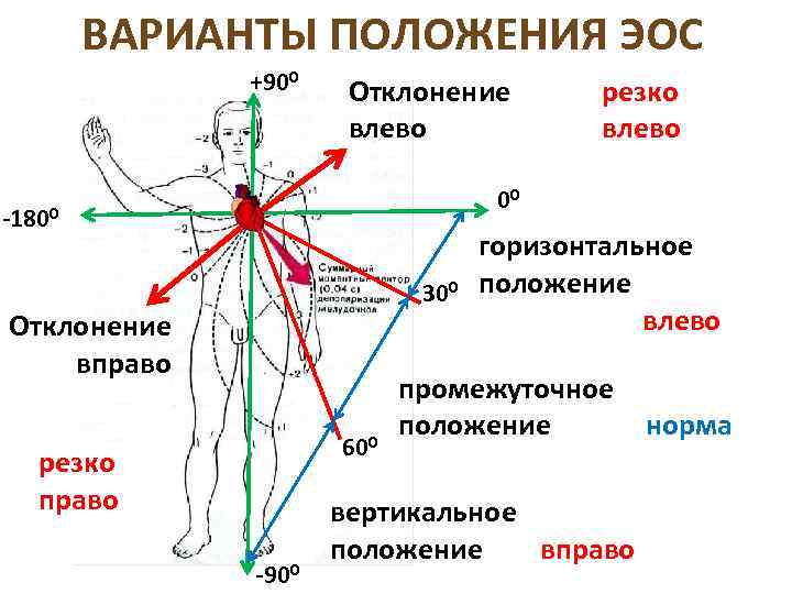 Варианты положения. Отклонение оси сердца влево на ЭКГ. Электрическая ось сердца отклонена резко вправо на ЭКГ. Отклонение электрической оси резко влево. Смещение электрической оси сердца влево на ЭКГ.