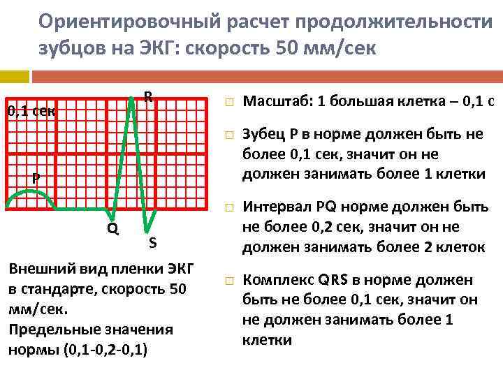 Ориентировочный расчет продолжительности зубцов на ЭКГ: скорость 50 мм/сек R 0, 1 сек Р