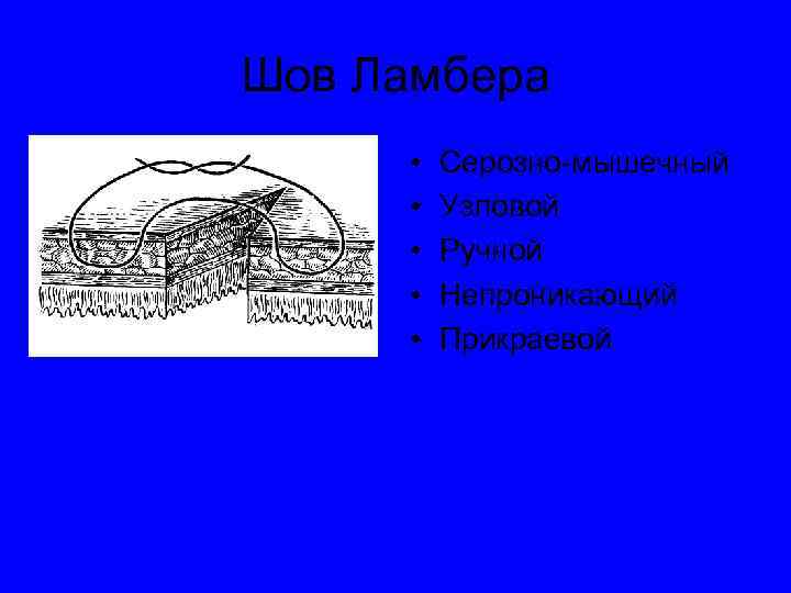 Кишечные швы топографическая анатомия презентация