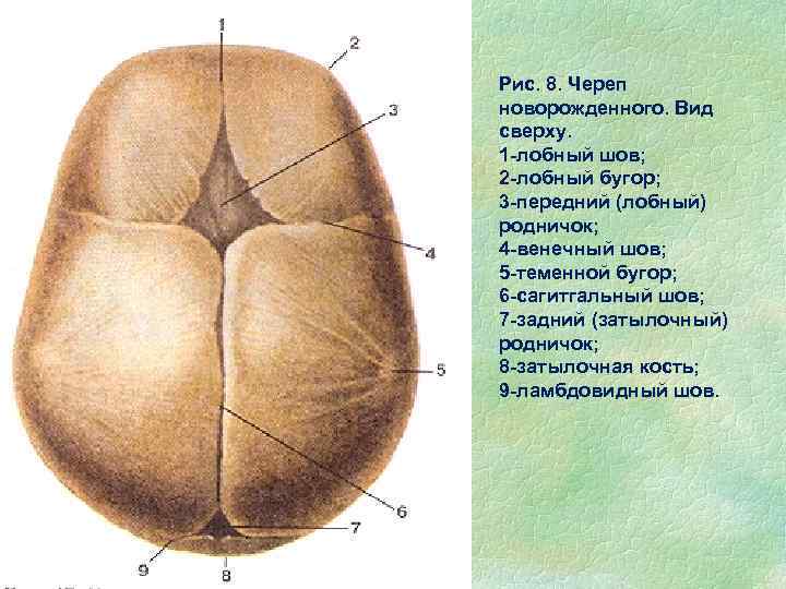 Рис. 8. Череп новорожденного. Вид сверху. 1 лобный шов; 2 лобный бугор; 3 передний