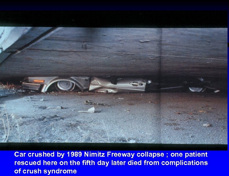 Car crushed by 1989 Nimitz Freeway collapse ; one patient rescued here on the