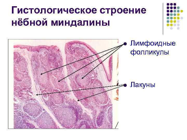 Гистологическое строение нёбной миндалины l Лимфоидные фолликулы l Лакуны 