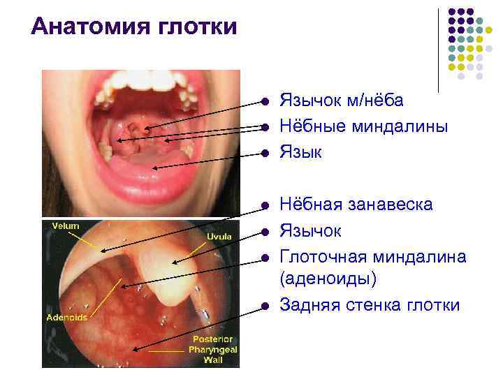 Анатомия глотки l l l l Язычок м/нёба Нёбные миндалины Язык Нёбная занавеска Язычок