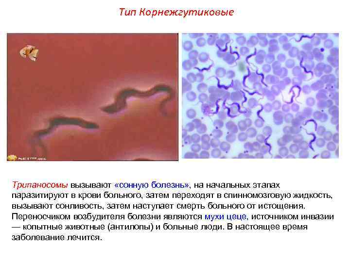 Тип Корнежгутиковые Трипаносомы вызывают «сонную болезнь» , на начальных этапах паразитируют в крови больного,