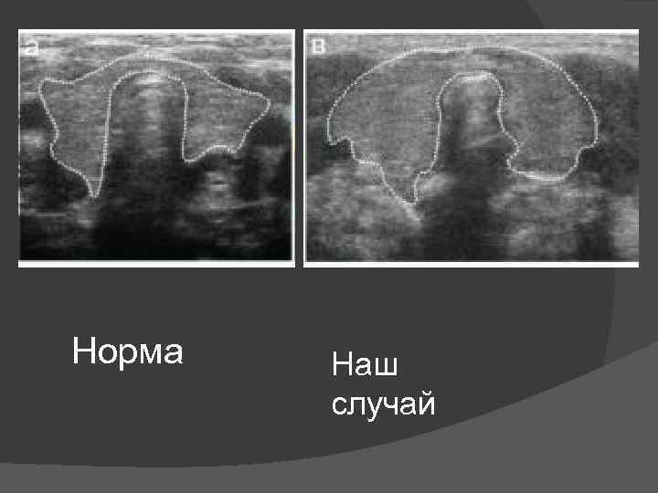 Норма Наш случай 