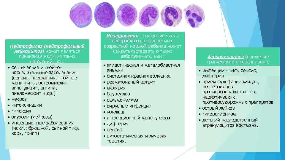 Нейтрофилез (нейтрофильный лейкоцитоз) может являться признаком наличия таких патологий, как: • септические и гнойновоспалительные