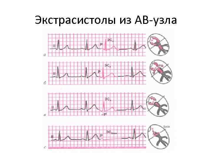 Нарушение сердечного ритма карта вызова скорой медицинской