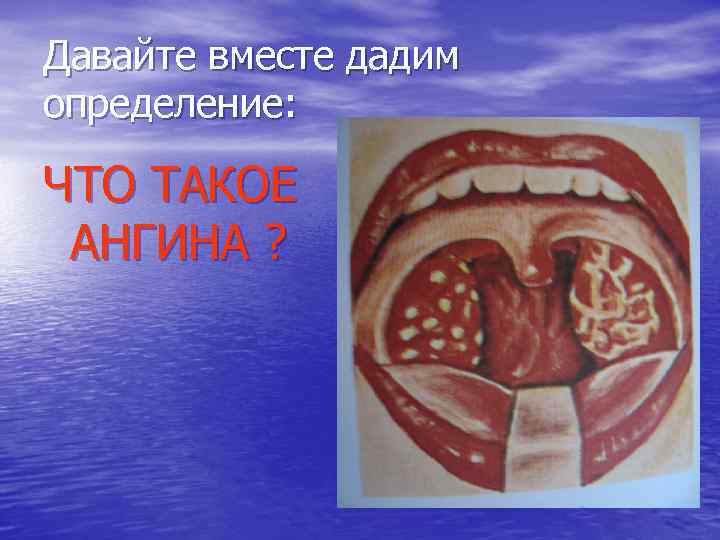 Давайте вместе дадим определение: ЧТО ТАКОЕ АНГИНА ? 