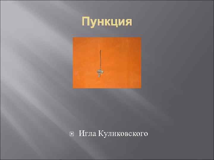 Пункция Игла Куликовского 