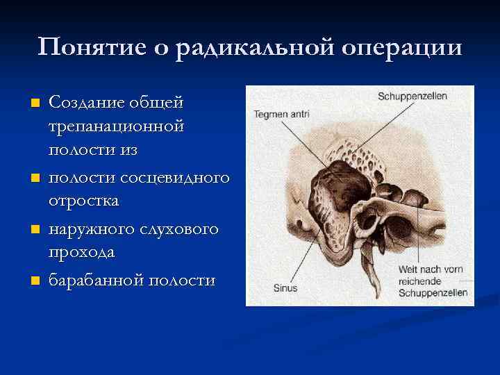 Мастоидит за ухом фото