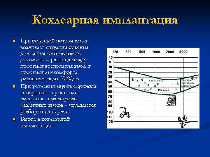 Кохлеарная имплантация n n n При большой потери слуха возникает ситуация сужения динамического звукового