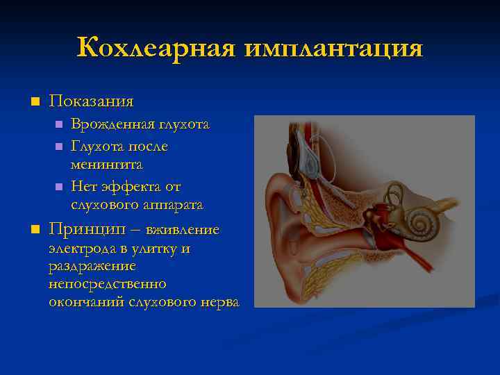 Кохлеарная имплантация n Показания Врожденная глухота n Глухота после менингита n Нет эффекта от