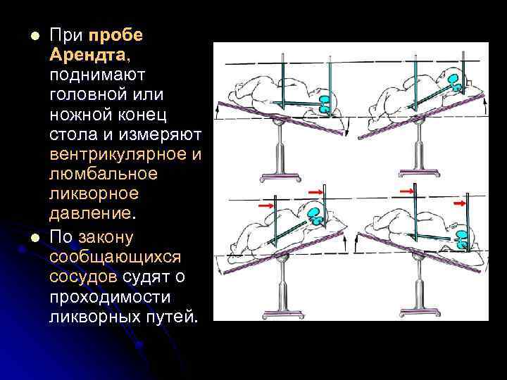 l l При пробе Арендта, поднимают головной или ножной конец стола и измеряют вентрикулярное