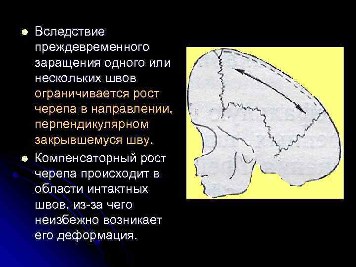 l l Вследствие преждевременного заращения одного или нескольких швов ограничивается рост черепа в направлении,