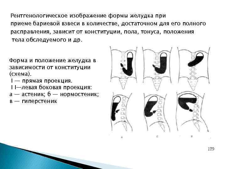 Рентгенологическое изображение формы желудка приеме бариевой взвеси в количестве, достаточном для его полного расправления,