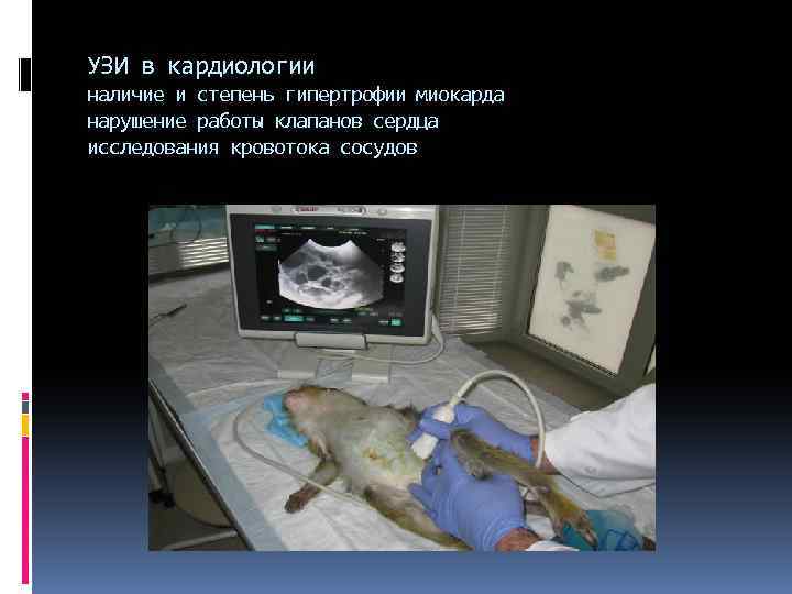 УЗИ в кардиологии наличие и степень гипертрофии миокарда нарушение работы клапанов сердца исследования кровотока
