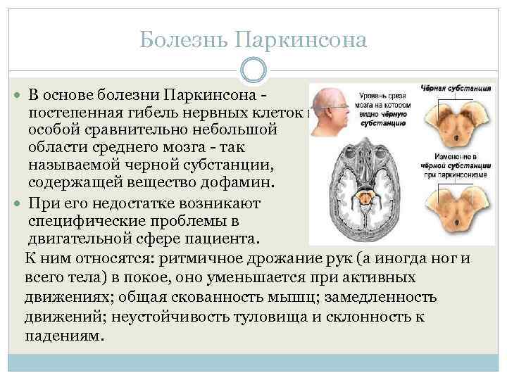 Болезнь Паркинсона В основе болезни Паркинсона - постепенная гибель нервных клеток в особой сравнительно