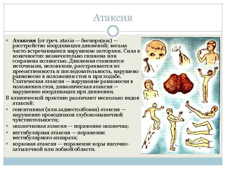 Атаксия (от греч. ataxia — беспорядок) — расстройство координации движений; весьма часто встречающееся нарушение