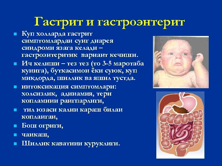 Гастрит и гастроэнтерит n n n n Куп холларда гастрит симптомлардан сунг диарея синдроми