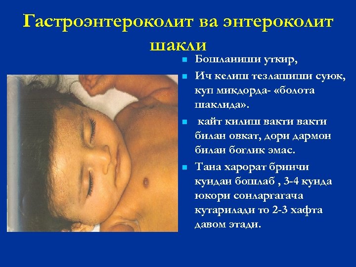 Гастроэнтероколит ва энтероколит шакли n n Бошланиши уткир, Ич келиш тезлашиши суюк, куп микдорда-