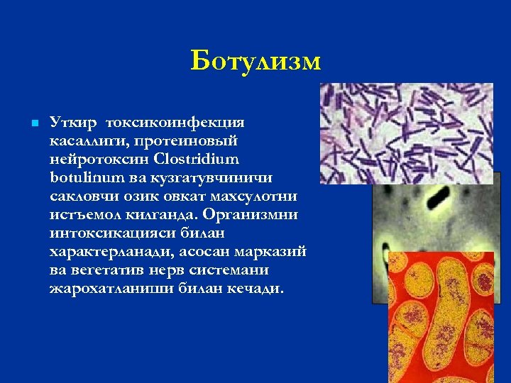 Патогенез ботулизма картинки